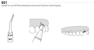 Extraktionsskalpell kompatibel Mectron Piezosurgery EX1