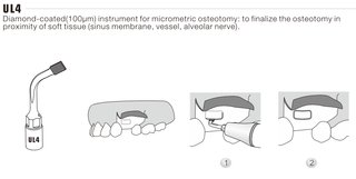 Osteotomie Instrument kompatibel Mectron Piezosurgery OT1
