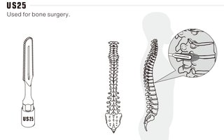 Osteotomie Microsaw kompatibel Mectron Piezosurgery