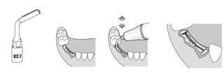 Extraktionsge / Osteotom kompatibel Mectron Piezosurgery